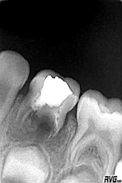 74 2005 jkoxq5 - Eugenol