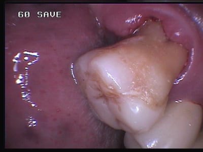 751 zfkhmw - Eugenol