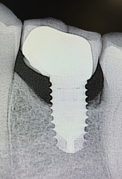 90k85z40xqasalmbfpgfloip5dq3 - Eugenol