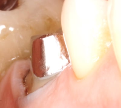 967b47af 363d 40c9 aa5f ce1b055ed1db wvtjmb - Eugenol