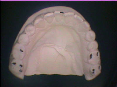 A13 f4cs1u - Eugenol