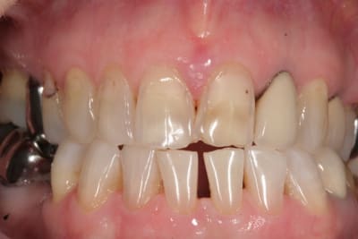 A3 zaw6gr - Eugenol