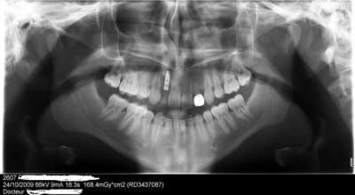Aaaa ivoe1h - Eugenol