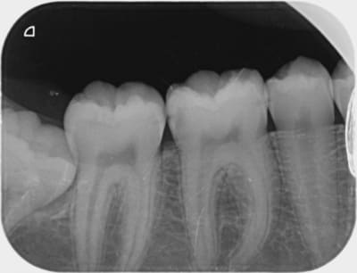 Alapex noemie 001 toxc83 - Eugenol
