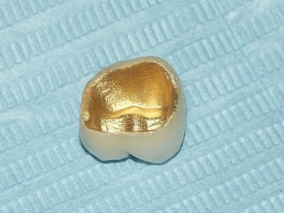 Armature n5oxz1 - Eugenol