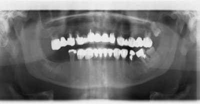 An02253 20121011 17 58 48 1 l52o5f - Eugenol