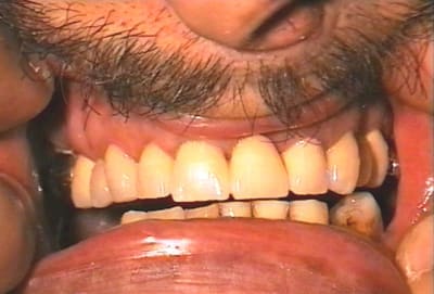 Après zebako - Eugenol