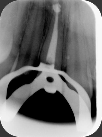 Apr s yk4me2 - Eugenol