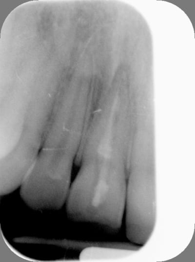 Avant dp5cha - Eugenol