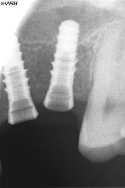 Bad2 wrewt4 - Eugenol