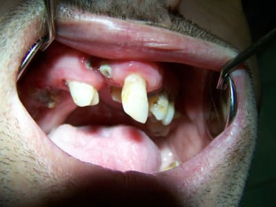 Bdl2 asoeq1 - Eugenol