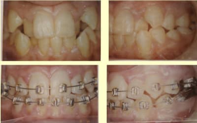 Bk 2 a65zpd - Eugenol