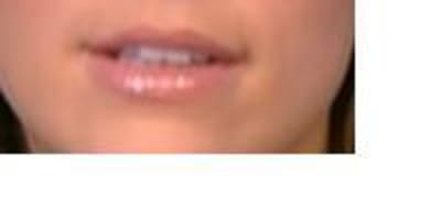 Bouche hyb4n3 - Eugenol
