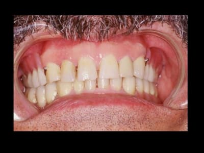 Buis 3 jqpin6 - Eugenol