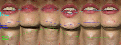 B pommeadam s0hlu5 - Eugenol