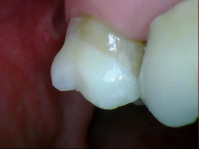 Belott 20120220 5 5 - Eugenol