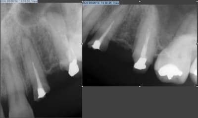 Brook aib7wz - Eugenol