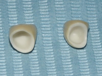 Cccarmatures lm4itu - Eugenol