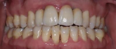Ccmant ft9nom - Eugenol