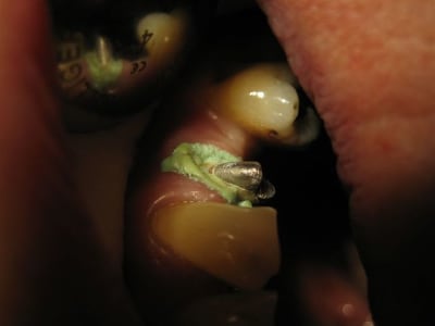 Cg 1 rpwej7 - Eugenol