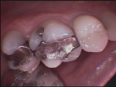 Civ en urgence2 xuocjc - Eugenol