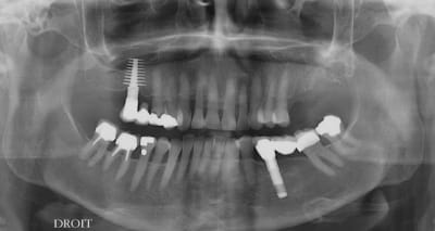 Conna jac16.07 - Eugenol