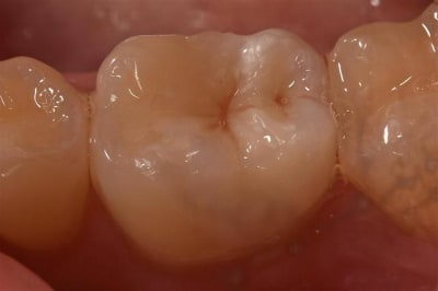 Crw 7548 fini  medium  xltqcu - Eugenol