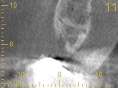 Cs 20131209 0838 11 rswuwa - Eugenol