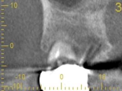 Cs 20131209 0838 3 ykcspp - Eugenol