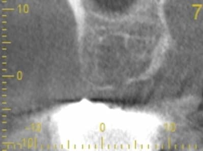 Cs 20131209 0838 7 hnjnmf - Eugenol