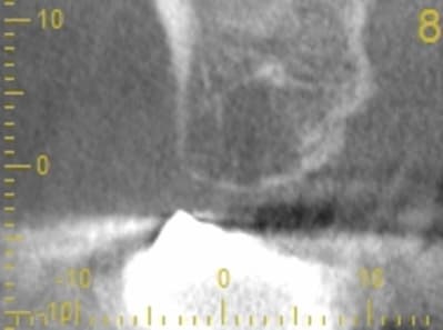 Cs 20131209 0838 8 exts1e - Eugenol