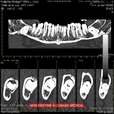 Ct2 svflfu - Eugenol