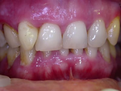 C dscn2375 zf96oz - Eugenol