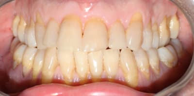 C img 0922 uuxerx - Eugenol