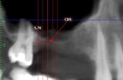 Capt 1956296 sqhfp8 - Eugenol