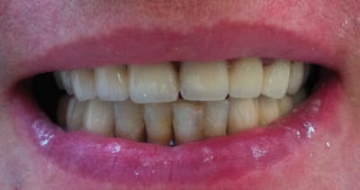 Capture d  cran 2014 02 09   00.54 - Eugenol