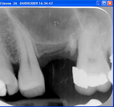 Capture d  cran 2016 04 28   09.50 - Eugenol