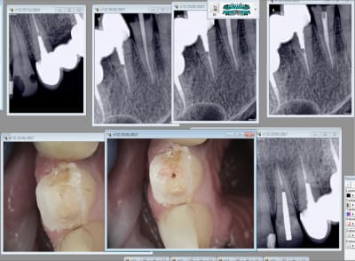 Capture d écran 2017 01 25 11.51 - Eugenol