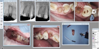Capture d écran 2017 02 14 21.07 - Eugenol