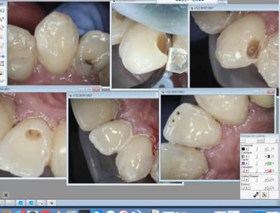 Capture d écran 2017 07 20 23.54 - Eugenol