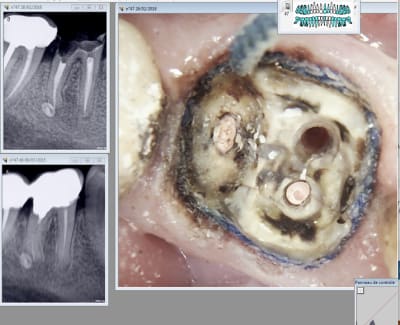 Capture d écran 2018 02 26 23.40 - Eugenol