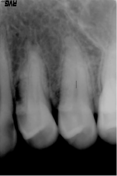 Capture d e cran 2015 04 24 00.38 - Eugenol