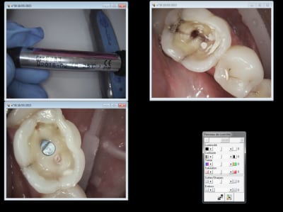 Capture d e cran 2015 05 18 20.30 - Eugenol