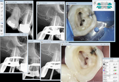 Capture d e cran 2015 06 03 22.16 - Eugenol