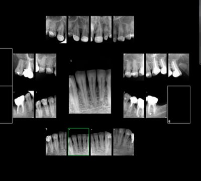 Capture d e cran 2016 01 12 15.54 - Eugenol