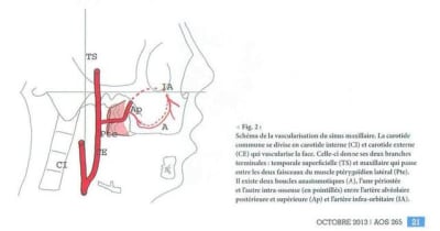 Capture iitsj9 - Eugenol