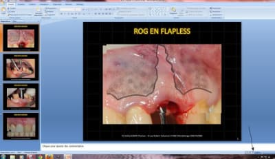 Capture kqr3ty - Eugenol