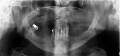 Capture mbqcku - Eugenol