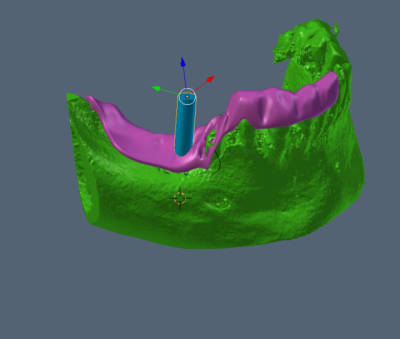 Capture mdfxte - Eugenol