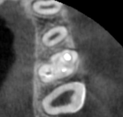 Capture plein  cran 27022016 115835 fddnqu - Eugenol